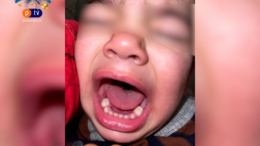 У Полтаві з дитячого садочку дитина повернулася з розрізаним язиком
