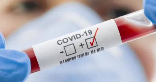 За тиждень на Полтавщині виявили 487 нових випадків COVID-19