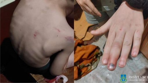 У Кременчуці чоловік катував дітей: в одної дитини кульове поранення